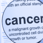 Cancer Prevention Naturally: Top Foods, Habits & Risk Factors