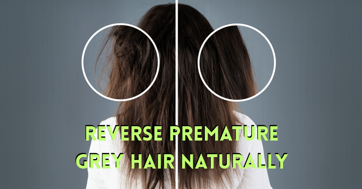 Read more about the article 7 Ayurvedic Remedies for Premature Grey Hair: Natural Solutions That Work